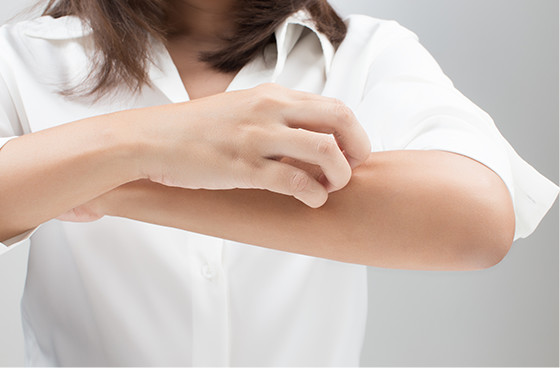 写真:アレルギー対策に困っている